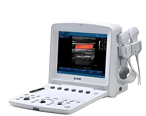 便攜式彩色超聲診斷系統(tǒng)sonosite zx 廠家