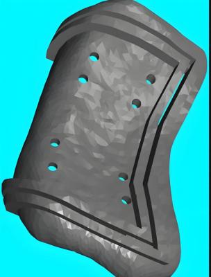 ty-jgdb-sz 個(gè)性化增材制造截骨導(dǎo)板廠家