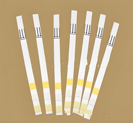 多項(xiàng)尿液分析試紙條（干化學(xué)法） 廠家